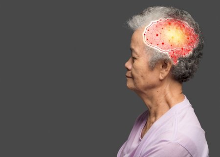 Menopausa pode ajudar a explicar por que mulheres têm mais casos de demência