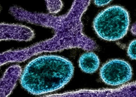 Nipah, gripe K, aviária: doenças no radar de infectologistas em 2026