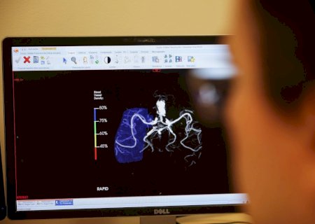 IA na saúde vai bem na teoria, mas falha com pacientes reais, mostra estudo