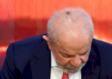 Lula aparece no Planalto com mancha na cabeça após cauterização