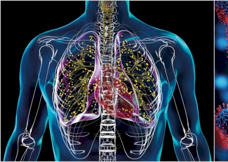 Velha inimiga: por que a tuberculose ainda não é uma doença do passado
