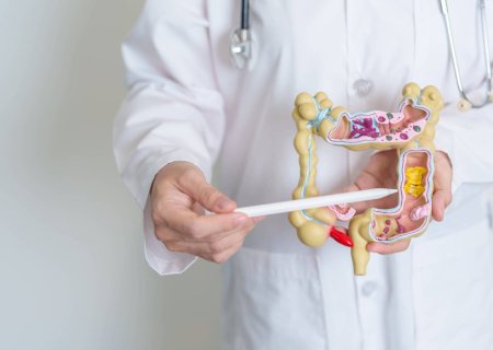 Idade é principal fator de risco para morte por câncer colorretal