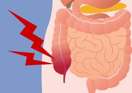 Para que serve o apêndice? Biólogos explicam a evolução do órgão
