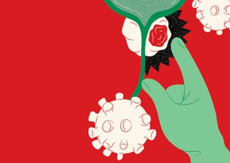 Câncer de próstata: como revolução silenciosa elevou tratamento em 15 anos