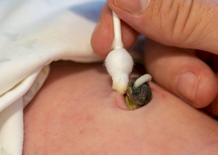 Os riscos de guardar e consumir tecido humano, como cordões umbilicais