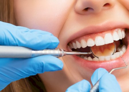 Da boca para o corpo: novos estudos disparam alerta sobre dentes em mau estado