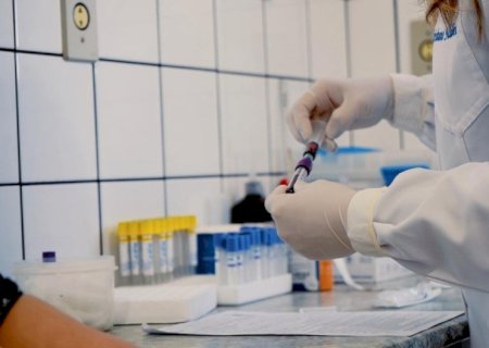 Laboratório Municipal de Batayporã terá novo horário de coleta a partir de 22 de abril