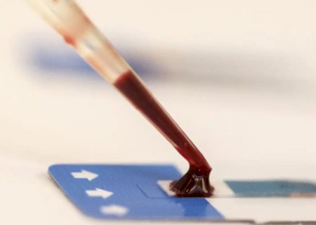 Estudo inédito da Fiocruz pode ampliar prevenção de HIV entre jovens
