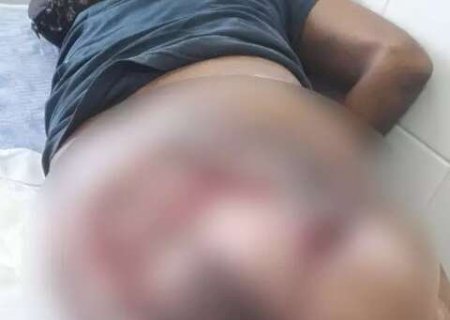 Sem esparadrapo e luvas, paciente denuncia falta de insumos para curativos