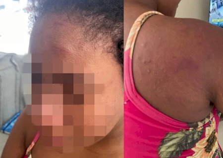 Doméstica agredida por patroa afirma que tentou proteger bebê