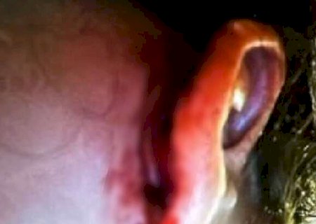 Suspeito de estuprar bebê foi indiciado por espancar e provocar aborto na ex