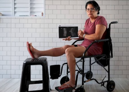 'Ligaram para perguntar se eu estava viva', diz mulher que espera desde 2022 por cirurgia em São Paulo