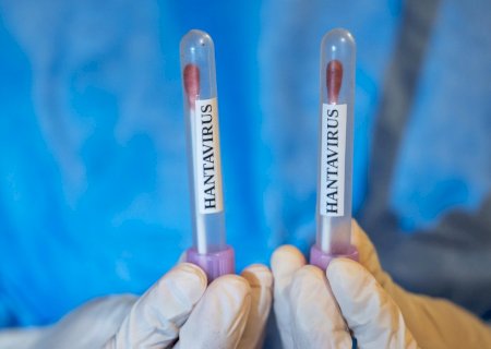 Hantavírus pode permanecer no sêmen anos após infecção, sugere estudo