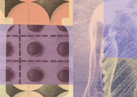 Mulheres recorrem a antialérgicos para aliviar sintomas de TPM e menopausa