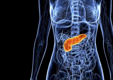Vem aí a primeira caneta de uso mensal para baixar os triglicérides e reduzir risco de pancreatite