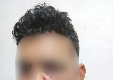 Horas após criança ferida, trabalhador acorda baleado no rosto dentro de casa