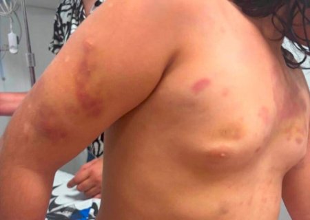 Em áudio, mãe de autista agredida diz que padrasto era 'figura de pai'