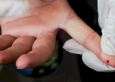 Brasil atinge meta de redução da transmissão vertical de hepatite B
