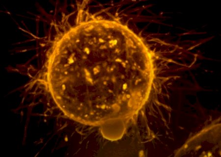 Cientistas descobrem possível forma de desativar progressão do câncer