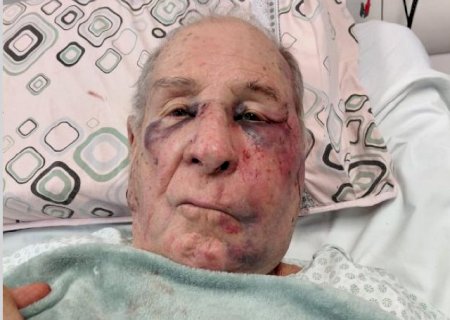 Justiça determina internação de homem acusado de matar idoso espancado