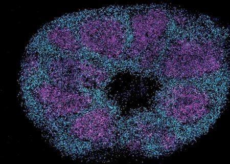 Estudo de proteínas cerebrais traz otimismo sobre tratamento para autismo