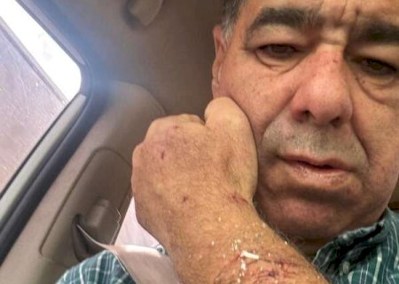 Com faca e garrafada, confusão em subprefeitura termina em delegacia
