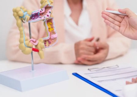 Pacientes com câncer colorretal têm medicamento aprovado pela Anvisa