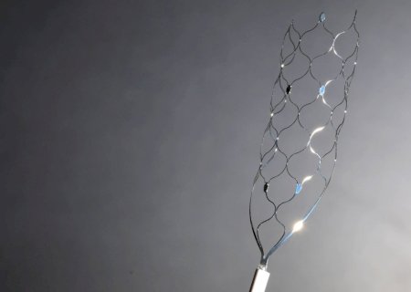 Nova técnica pode desobstruir artérias calcificadas sem uso de stent