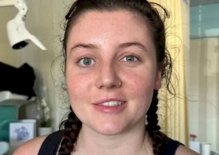 'O que aprendi ao ter um AVC aos 26 anos'