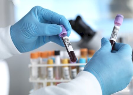 Exame de sangue para auxiliar no diagnóstico de Alzheimer chega ao Brasil