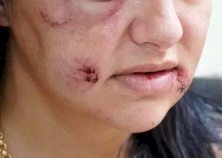 Feminicídio vai entrar na lista internacional de doenças da OMS