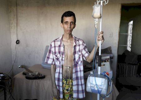 Sem diagnóstico, pacientes com doenças raras passam anos em busca de respostas
