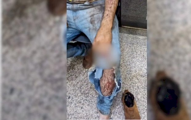 Trabalhador é atacado por onça durante trabalho em lavoura em MS