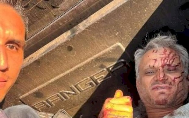 “Nunca vi nada igual”, diz policial que encarou chamas para salvar motorista